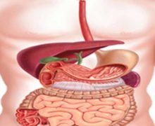 مشکلات دستگاه گوارش