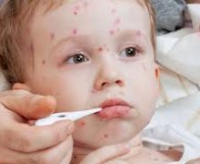 نشانه های بیماری ها در کودکان