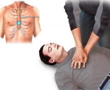احیای-قلبی-ریوی