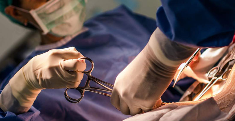 مدت زمان عمل سزارین