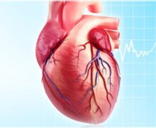 دکتر قلب و عروق پیروزی