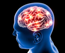 دکتر مغز و اعصاب بهشتی